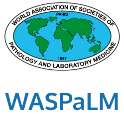 WASPaLM